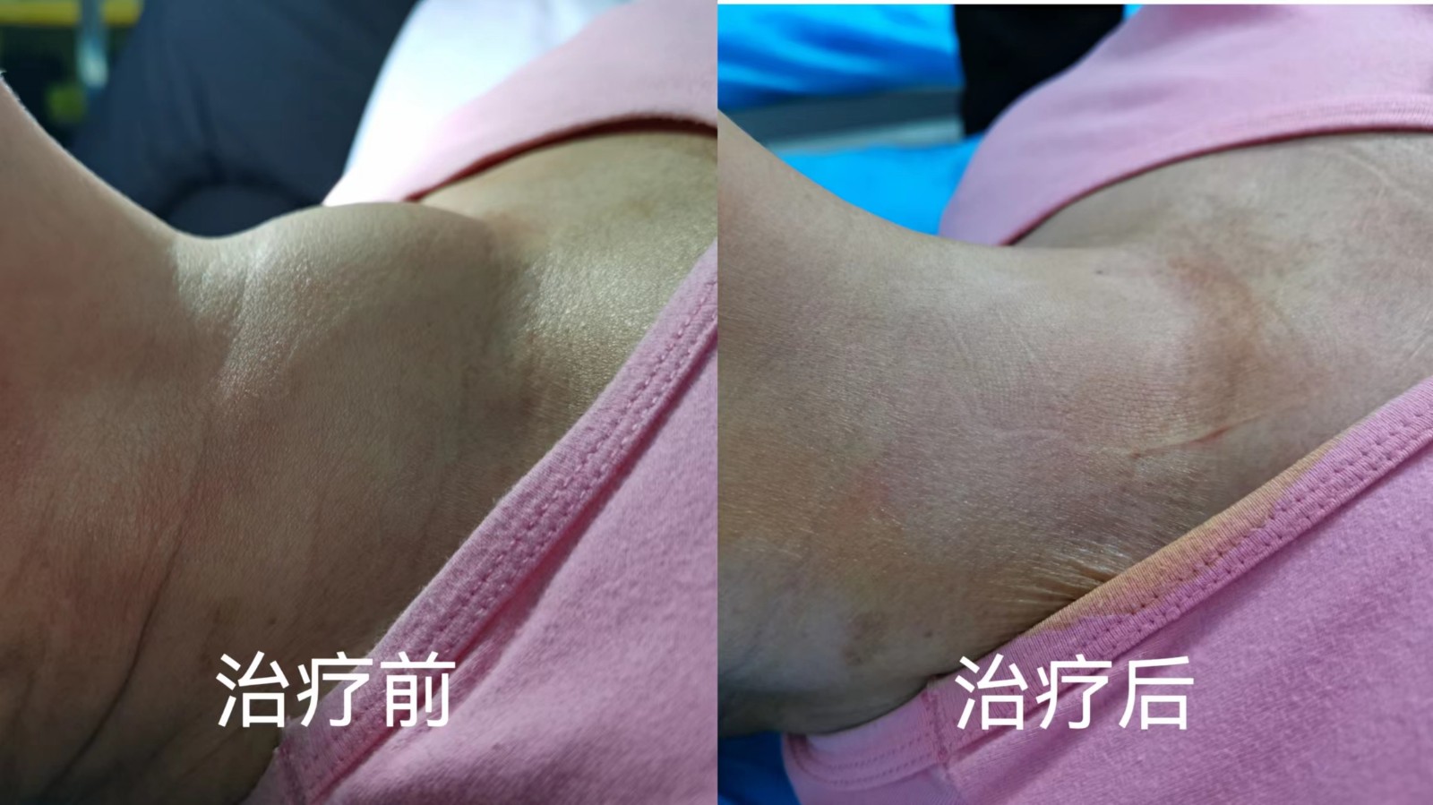 胎儿四维超声检查.jpg
